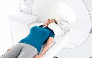Что входит в МРТ-исследование мягких тканей шеи и головы, какие патологии показывает томограмма?