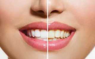 Что делать, если болят зубы после процедуры отбеливания: как снизить повышенную чувствительность?