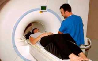 Что показывает МРТ-исследование пояснично-крестцового отдела позвоночника, и как проводится томография?