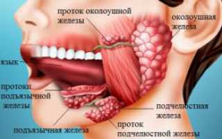 Симптомы слюннокаменной болезни (сиалолитиаза) и лечение железы посредством удаления камней
