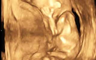 Что показывает УЗИ на сроке в 14 недель беременности, каковы исследуемые нормы?