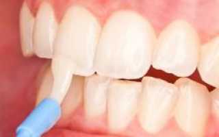 Методика глубокого фторирования молочных зубов у детей: фото до и после процедуры