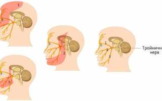 Анатомия тройничного нерва: схема расположения ветвей и точек выхода на лице человека с фото