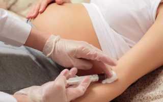 Виден ли пол будущего ребенка на УЗИ диагностике в 15 недель беременности?