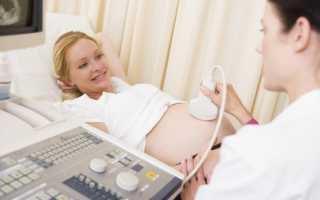 На УЗИ по беременности срок меньше или больше, чем по месячным — почему и стоит ли волноваться?