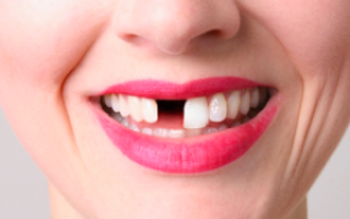 К чему могут сниться зубы: толкуем выпадение без крови, зубную боль и другие проблемы по сонникам