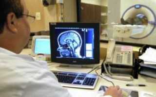 Показания для МРТ спинного и головного мозга  — что показывает обследование?