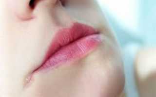 Причины появления трещин в уголках губ (рта) и эффективные средства для лечения кожи в домашних условиях