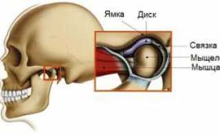 Симптомы воспаления челюстно-лицевого сустава и способы лечения артрита ВНЧС
