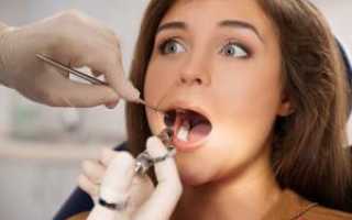 Имплантация зубов во время беременности и перед ее наступлением: в каких случаях можно делать?