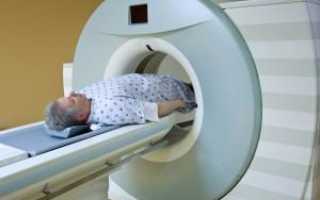 МРТ-диагностика предстательной железы: что показывает исследование простаты с контрастированием и без?