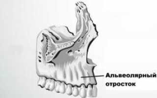Что такое альвеолы зубов и зачем они нужны во рту, где находятся и как выглядят на фото?