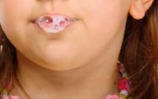 Причины вязкой густой слюны по утрам и лечение тягучей слизи во рту у взрослых
