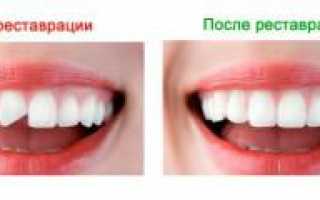 Наращивание передних зубов на штифт или корень: фото до и после реставрации, плюсы и минусы процедуры