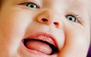 Понятие синдрома прорезывания зубов у детей, симптомы и назначаемое лечение