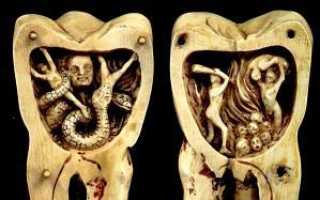 Вся правда о черве в зубах и деснах: как лечили людей в древности и Средневековье?