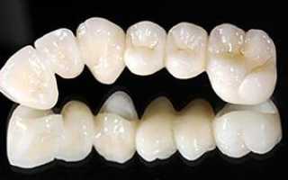 Диоксид циркония или металлокерамика: плюсы и минусы циркониевых коронок на зубы, фото до и после протезирования