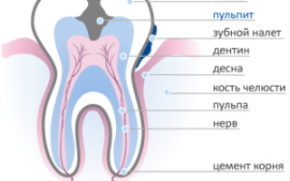 Реминерализирующий гель для зубов РОКС Медикал Минералс: инструкция для детей и взрослых