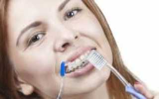 Как правильно ухаживать за брекет-системой после установки — питание для зубов и средства для чистки