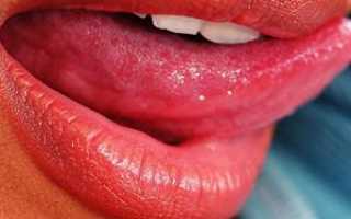 Почему может болеть язык по бокам, чем лечить покалывание: причины неприятных ощущений и средства от дискомфорта во рту