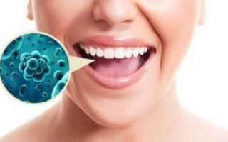 Как восстановить нормальную микрофлору полости рта при появлении кариеса и пародонтоза?