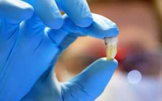 Как остановить кровь в домашних условиях после удаления зуба: что делать если кровотечение не останавливается?