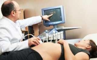 Определение срока беременности и даты родов по УЗИ — насколько точны будут расчеты?