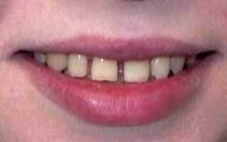 Что означает щель между передними и боковыми зубами, их острая форма, мелкие или крупные размеры?