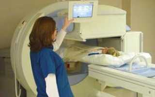 МРТ шеи и сосудов головного мозга — что показывает томография артерий головы и сколько стоит процедура?