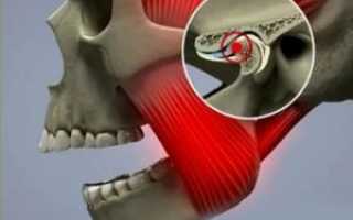 Строение челюстного сустава: почему он болит и челюсть больно открывать?