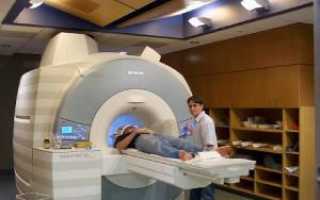 МРТ головы и головного мозга: полный список того, что показывает исследование