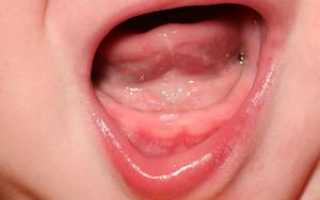 Сопли и заложенность носа во время прорезывания зубов: может ли быть «зубной» насморк у ребенка и как его лечить?
