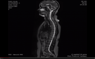 МРТ для грудного и поясничного отдела позвоночника — что показывает томография и как ее делают?
