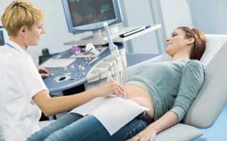 Сколько раз можно делать УЗИ диагностику при беременности, не вредно ли частое исследование на ранних сроках для плода?