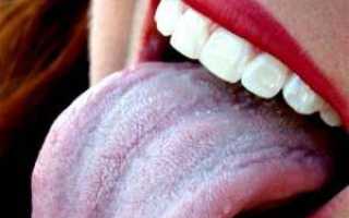 Признаки стоматита на языке и быстрые способы лечения заболевания у взрослых
