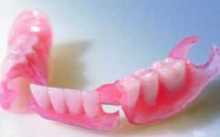 Привыкание к съемным зубным протезам: процесс адаптации верхней и нижней челюсти