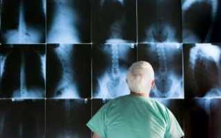 Как делают МРТ тазобедренных суставов, что показывает и сколько стоит томография?