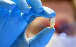Дают ли больничный после удаления восьмерок и других зубов, при флюсе и зубной боли?