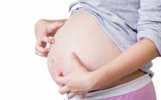 Холестаз беременных: симптомы и лечение