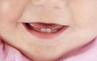 Красные щеки у грудничка: может ли быть покраснение при прорезывании зубов у ребенка?