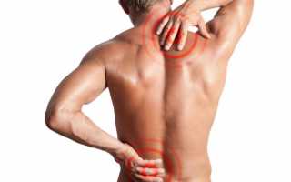 Что показывает и как подготовиться к УЗИ спины — шейного, поясничного и грудного отдела позвоночника?