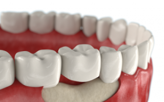 Что делать при разрушении и атрофии костной ткани зуба: можно ли ее восстановить?
