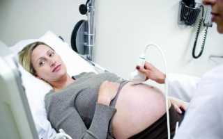 Что смотрят на 21 неделе беременности при исследовании плода, каковы нормы УЗИ в этом сроке?